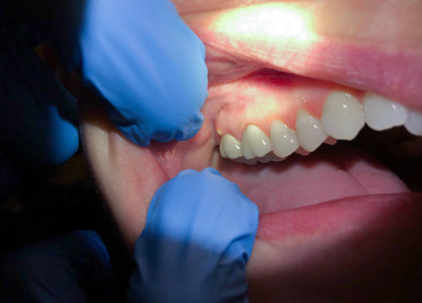 Best Emergency Dental Services for Seniors in Itasca, TX