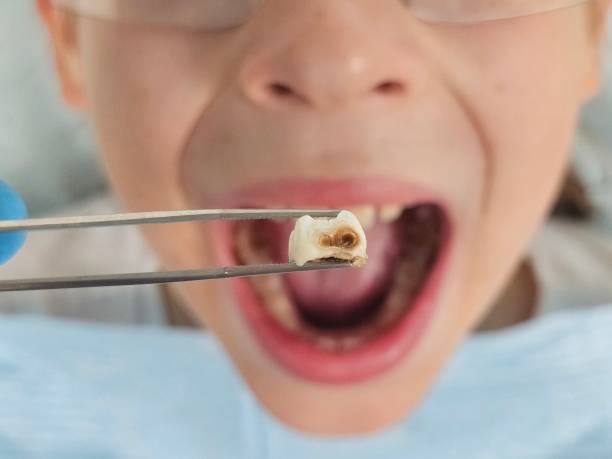 Best Holiday Emergency Dentist in Itasca, TX