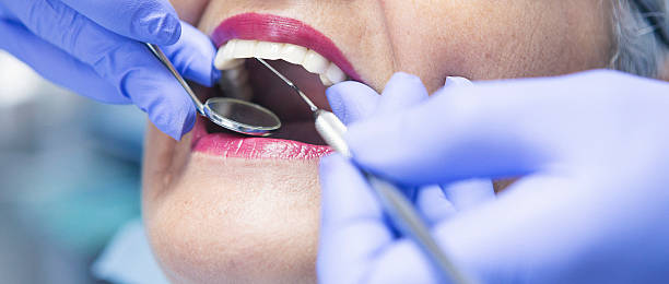 Best Emergency Dentist for Knocked-Out Tooth in Itasca, TX