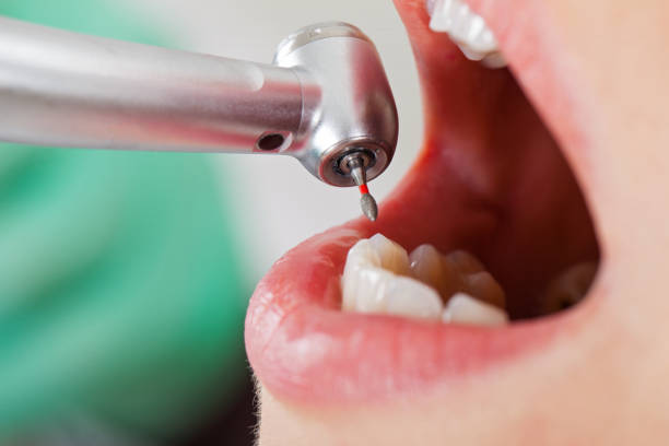 Best Emergency Dentist for Special Needs Patients in Itasca, TX